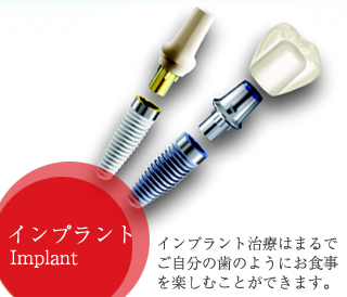 �C���v�����g