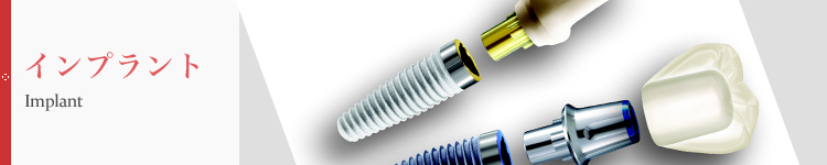 インプラント
